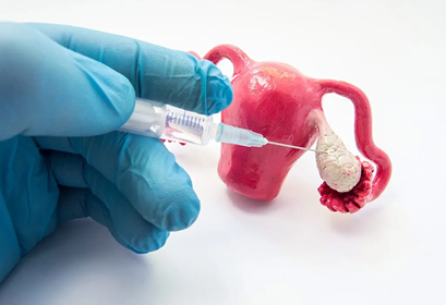 diagnosting infertility