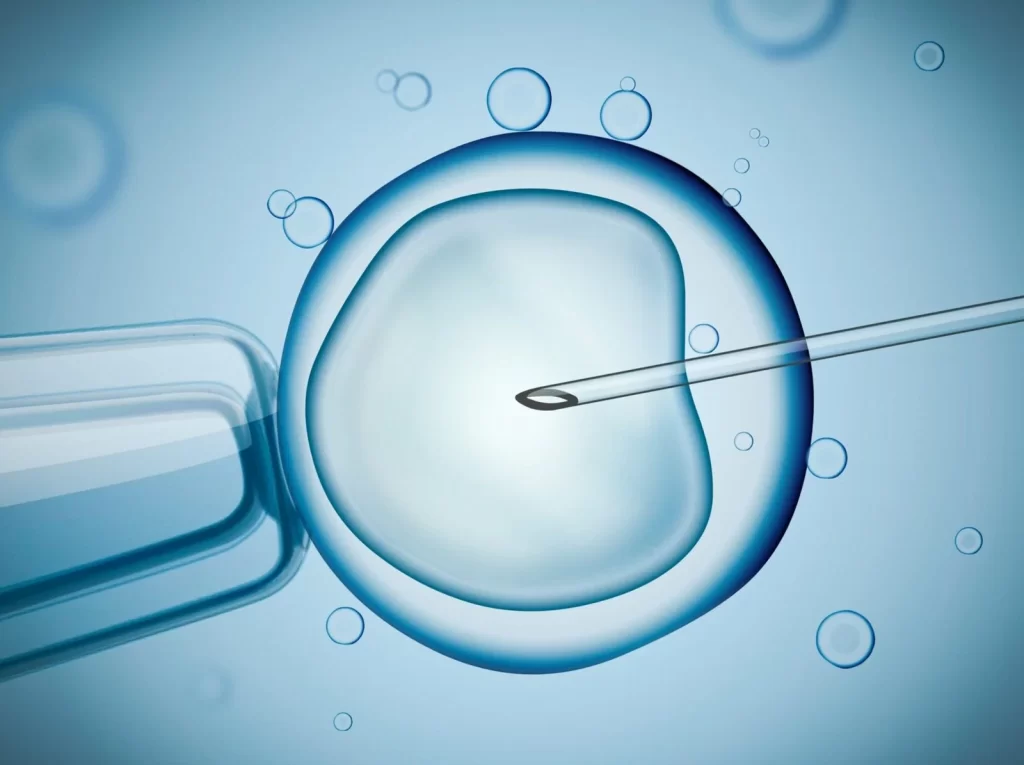In Vitro Fertilization